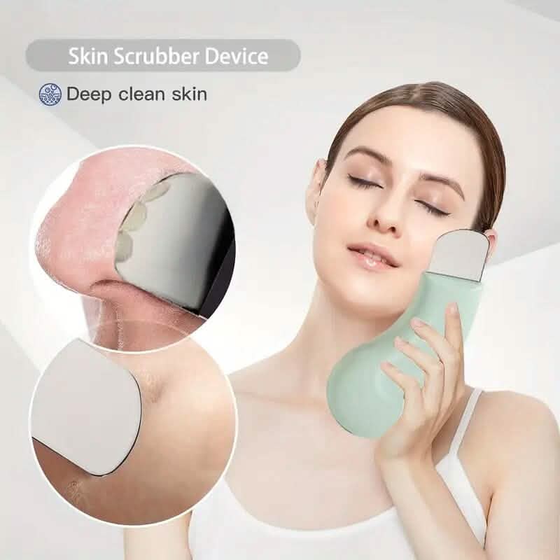 Blackhead Remover Tool Extractor by DailySale