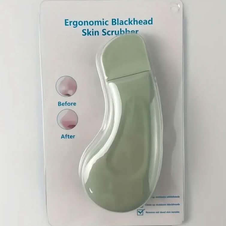 Blackhead Remover Tool Extractor by DailySale