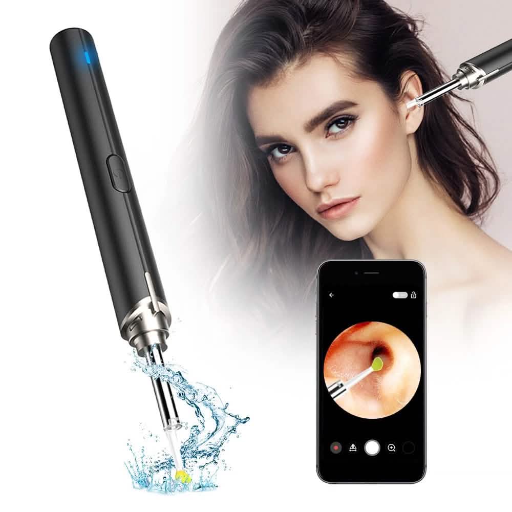 Intelligent Visual Ear Otoscope Inspection Tool by DailySale